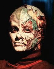 Dr. Danara Pel - Vidian saved by Voyager's EMH - Susan Diol